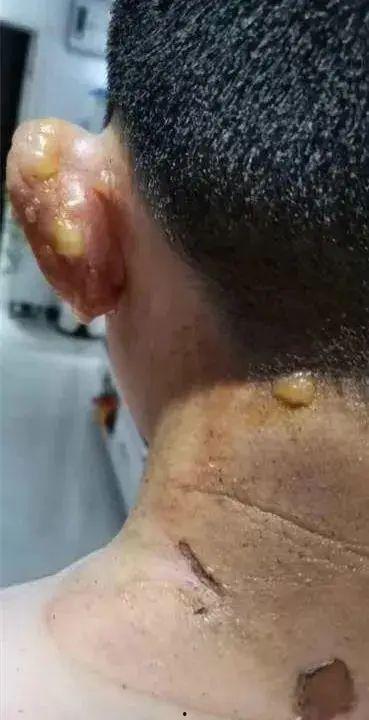 邯郸一小区爆料事件最新